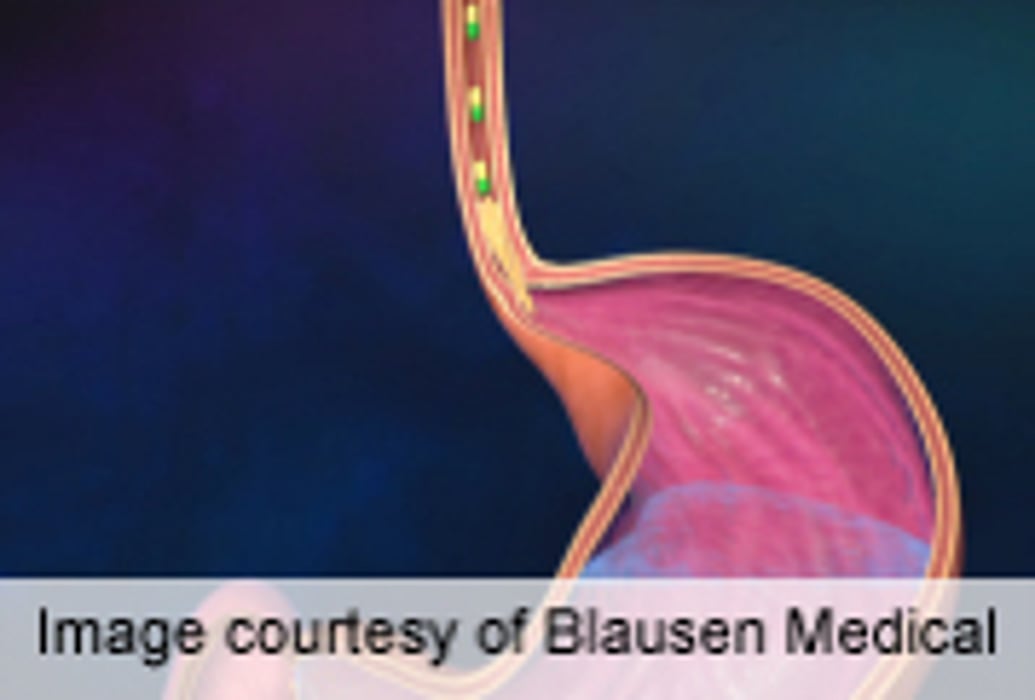 Exercise and Protein Intake Affect Gut Microbiota