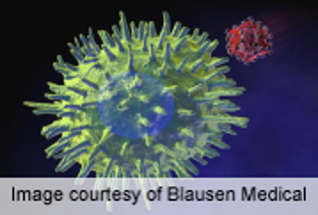 HIV-Associated Lymphoma Characterized As Heterogeneous