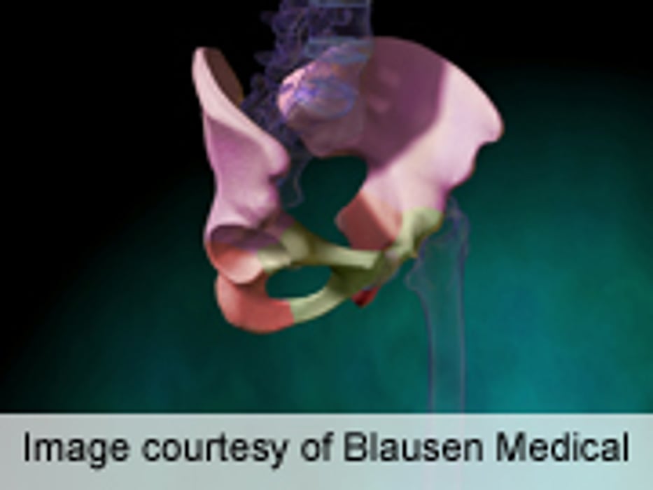 AAOS: Knee, Hip Arthroplasty Improves Sexual Function