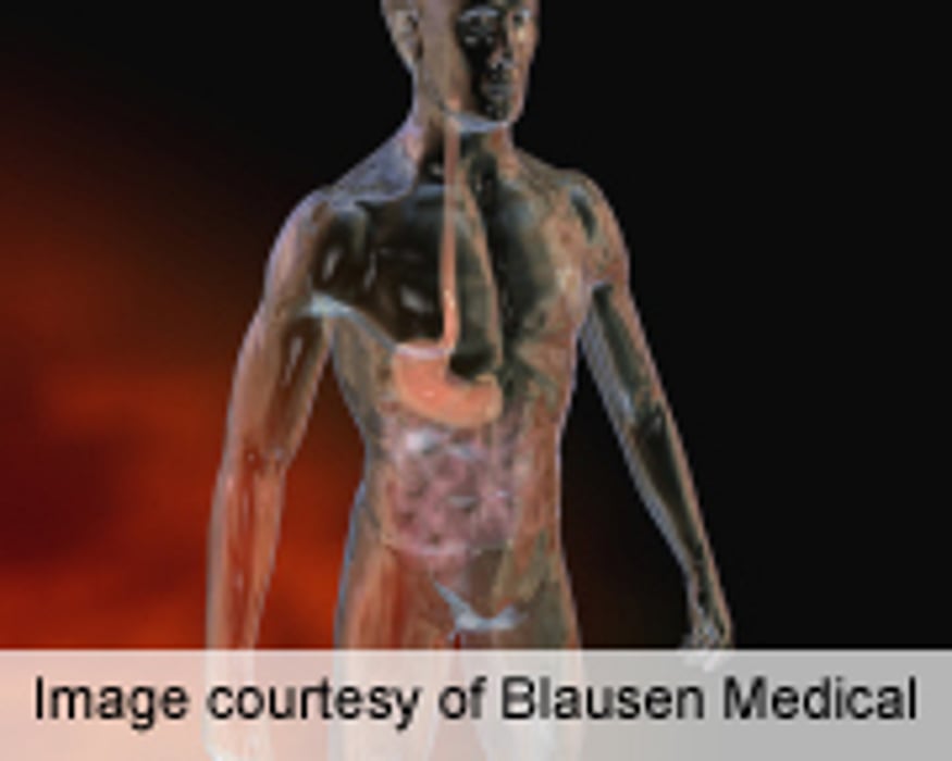 No Increased Cancer Risk With Glargine Versus Human Insulin