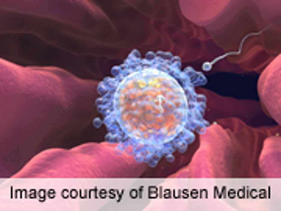 Fertility Treatment Tied to Higher Relapse Rate in Women With MS