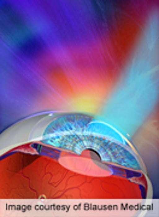Cerebral Damage Key Risk for Visual Impairment in Preemies