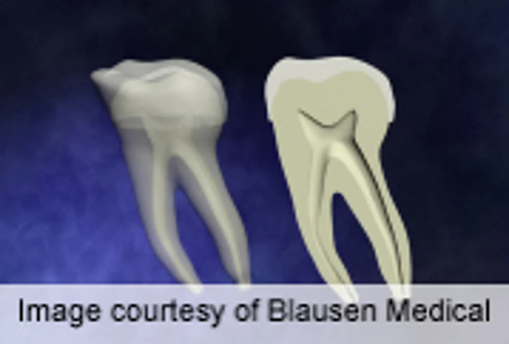 Dentists' Group Expands Use of Fluoride Toothpaste for Children