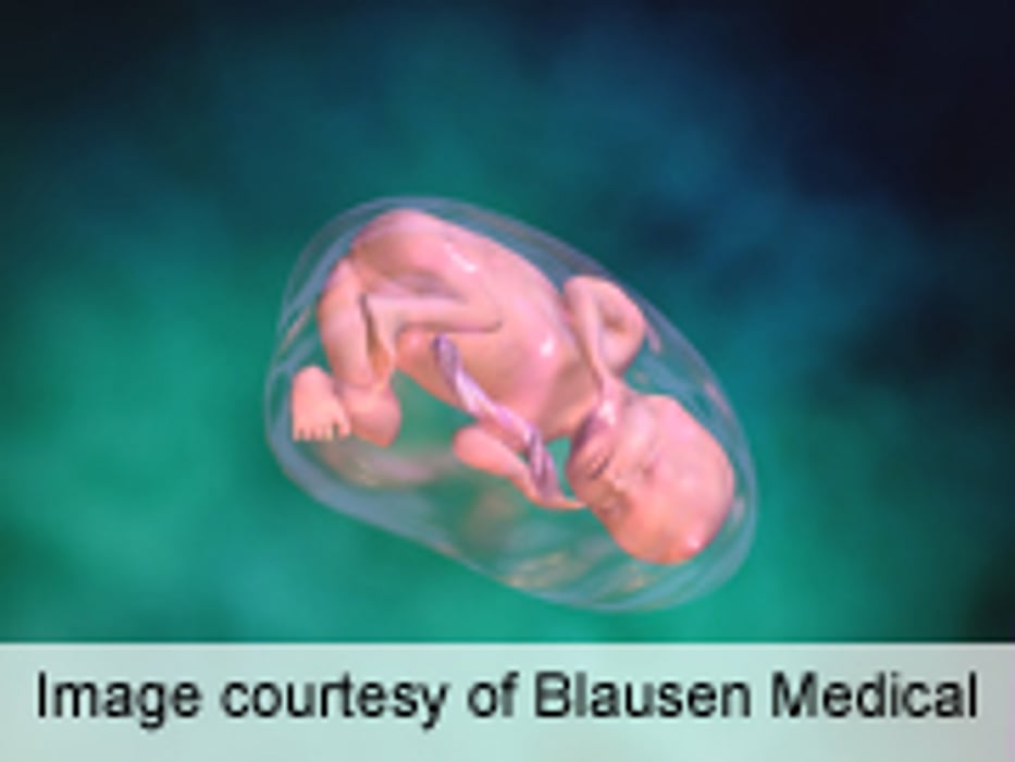 Lengthy Periods of Standing, Working Impact Fetal Growth