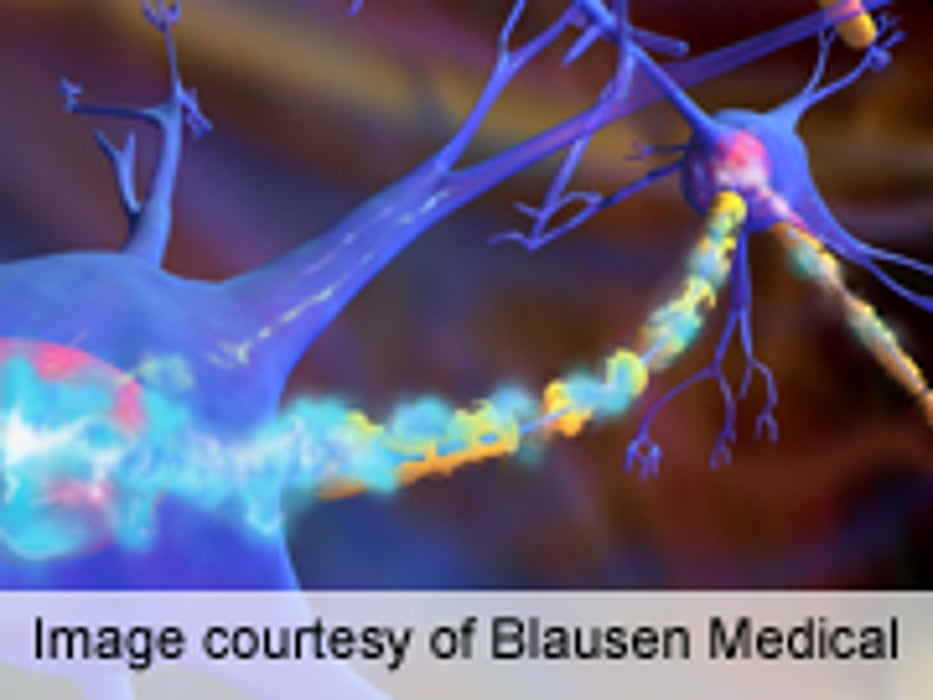 No Link Between Vaccinations, Risk for Multiple Sclerosis