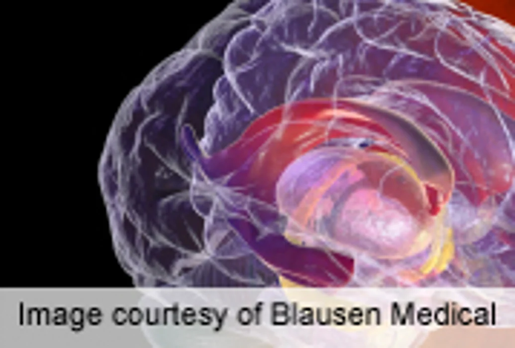 Common Etiology for ASD, Schizophrenia, Bipolar Disorder