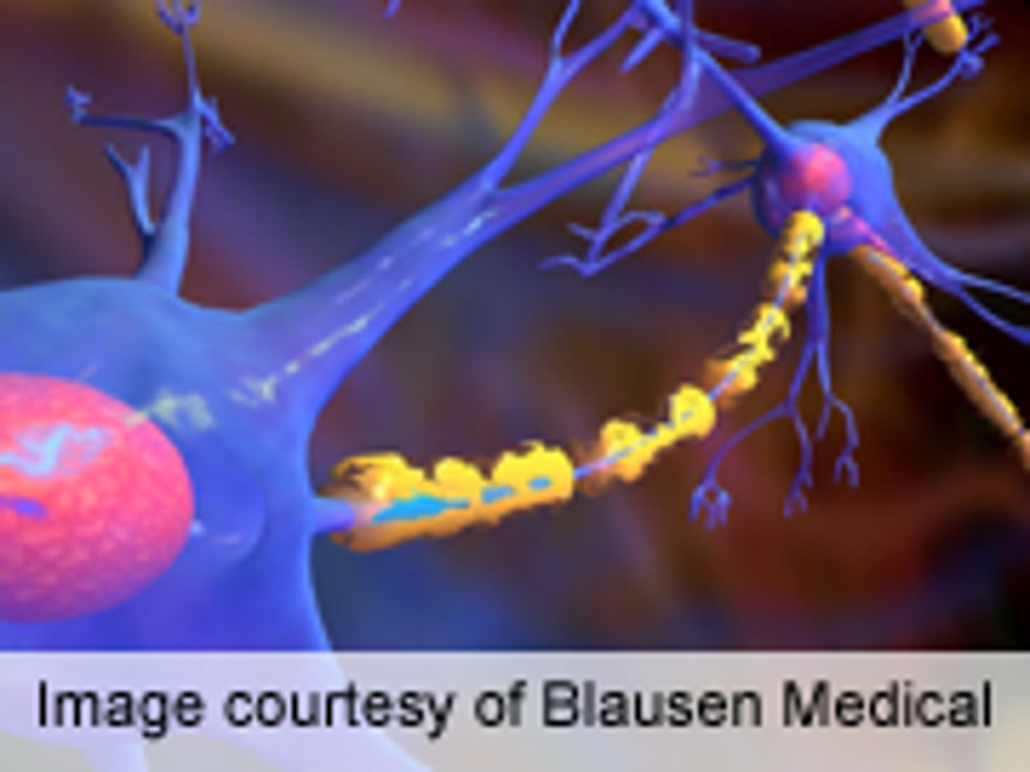 Video Game Improves Balance in Multiple Sclerosis Patients
