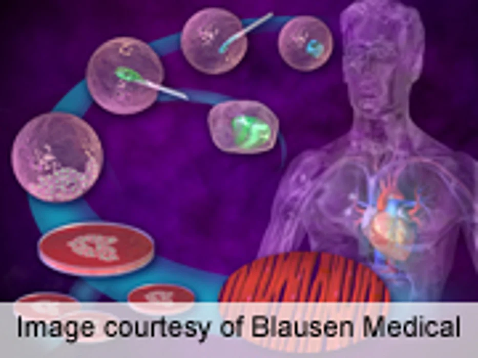 Stem Cells From Skin Can Display Huntington's Characteristics