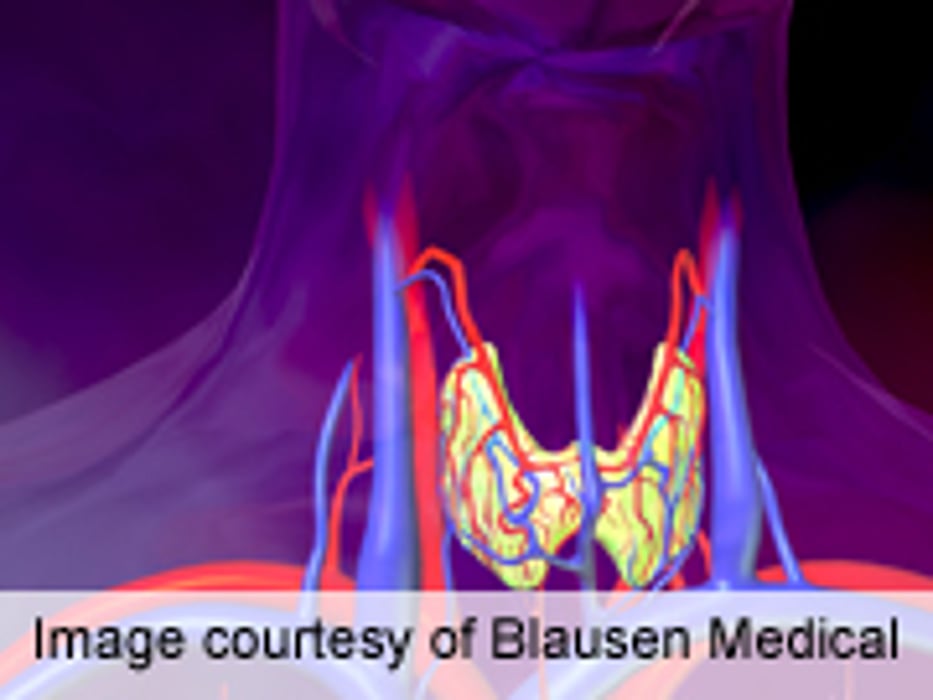 MicroRNA-222, -146b Levels Linked to Papillary Thyroid Cancer