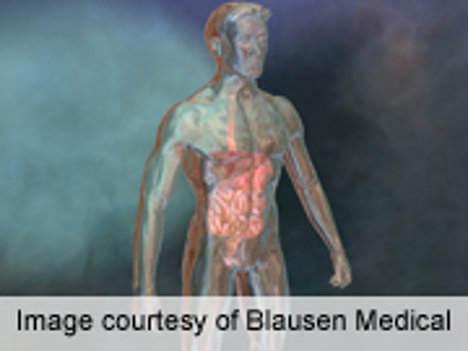 Pre-Op MRI of Margins Predicts Rectal Cancer Outcomes