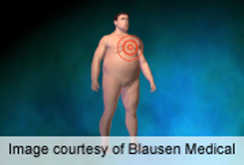 Large Waist Size Ups Risk of Premature Mortality