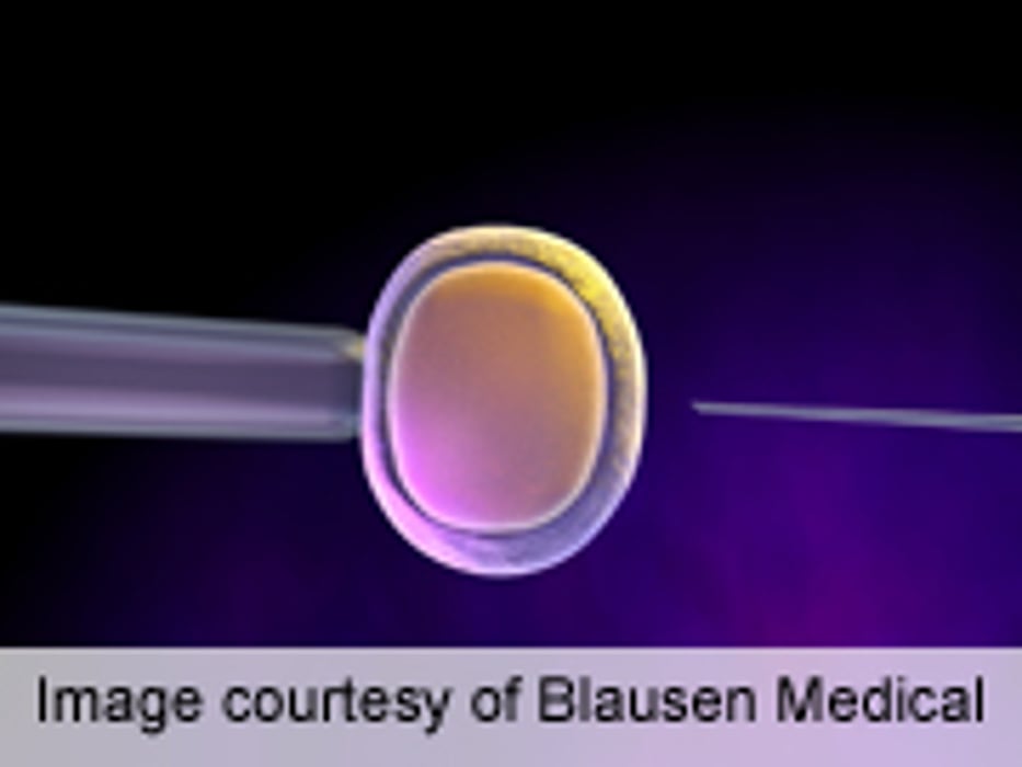 Severely Obese Women Attempting IVF May Have Lower Egg Quality