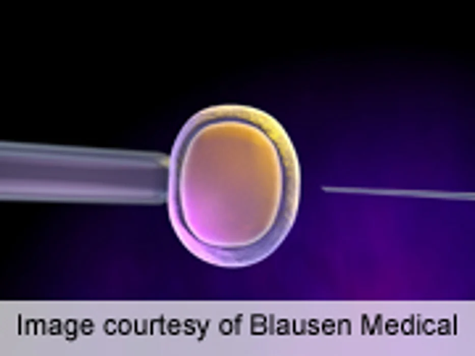 ACOG: Better Outcomes for IVF by Single-Embryo Transfer