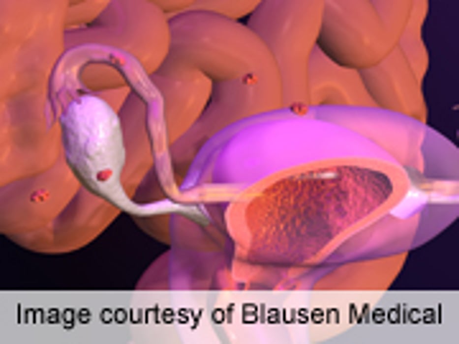 ESHRE: Perinatal Mortality Down With Single Embryo Transfer