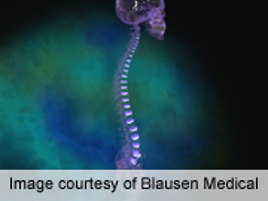 Substantial Increase in Spinal Interventional Techniques Seen