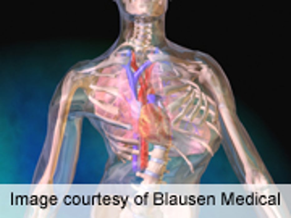 Self-Image Worse for Teens With Untreated Scoliosis