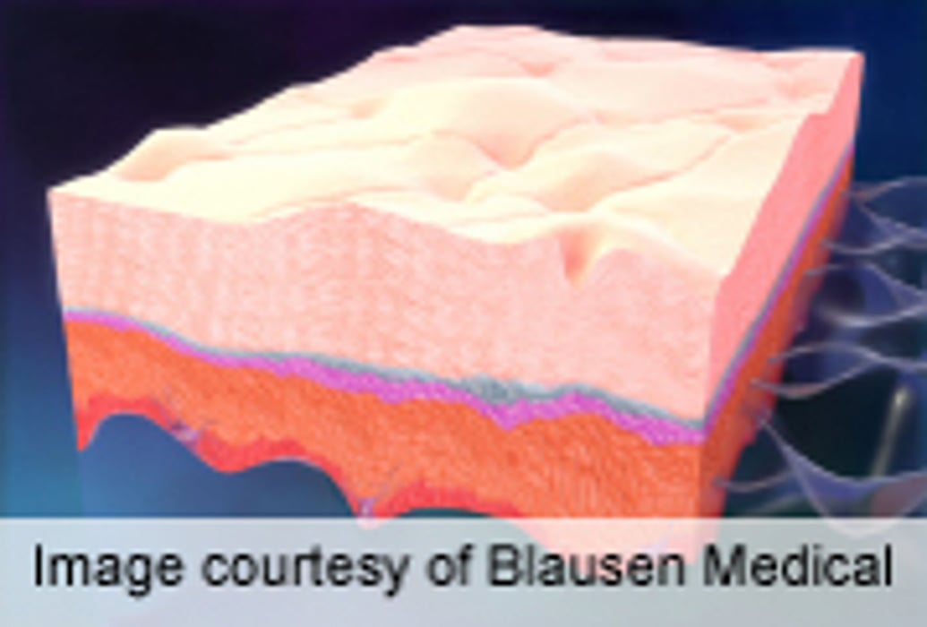 High Recurrence Risk With Severe Cutaneous Adverse Reactions