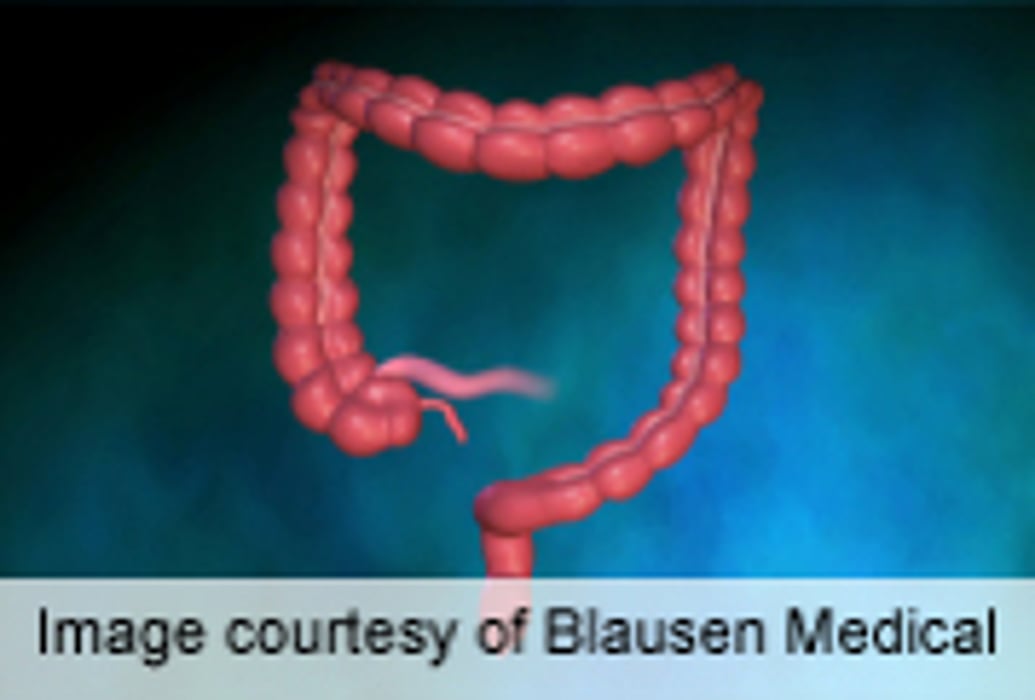 Universal Screening Modestly Ups Lynch Syndrome Diagnosis