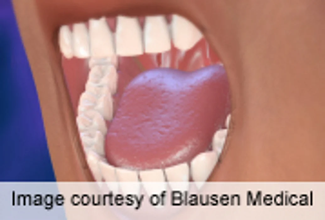 Some 'Super Tasters' Might Be Less Prone to Sinus Woes
