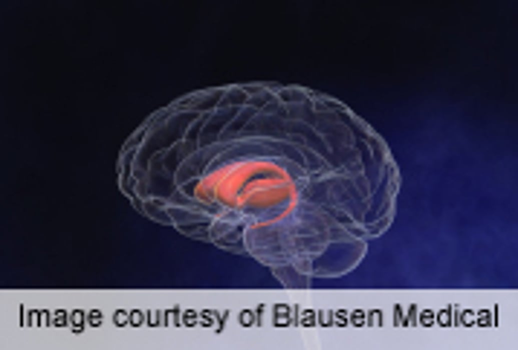 Specific Solvents May Increase Risk of Parkinson's Disease