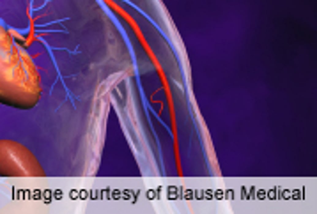 Review Supports Elevated Risk of CHD Even With Prehypertension