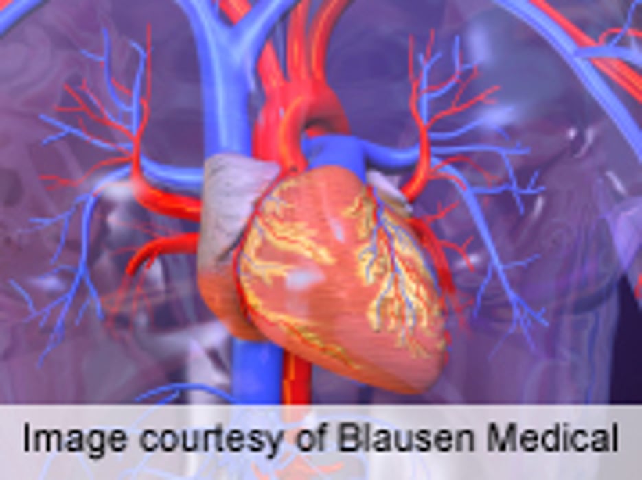 Performance Measures Developed for Adults Undergoing PCI