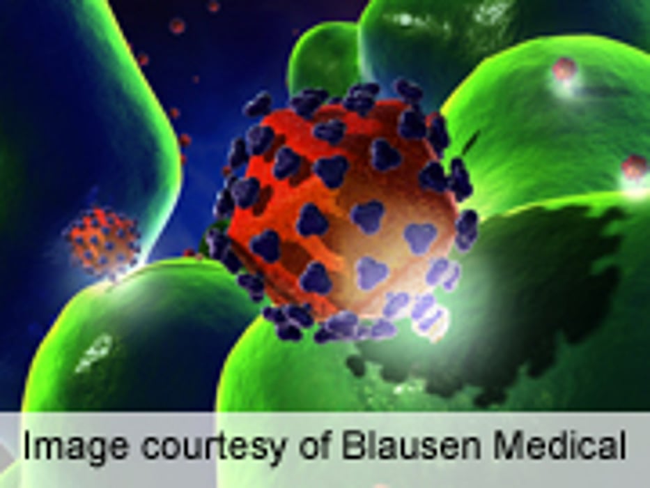About One in Six With HIV in U.S. Was Born Outside the U.S.