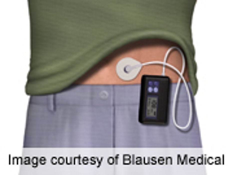 EASD: Insulin Pumps Reduce Mortality, Fatal CVD Risk