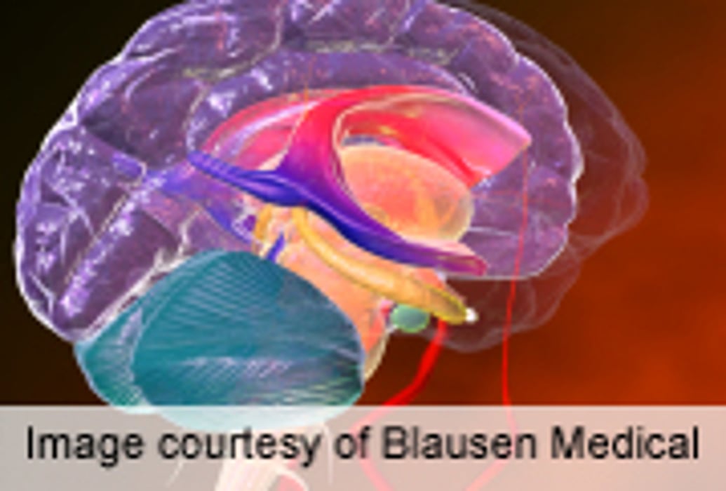Wives of Patients With Severe Sepsis at Risk for Depression