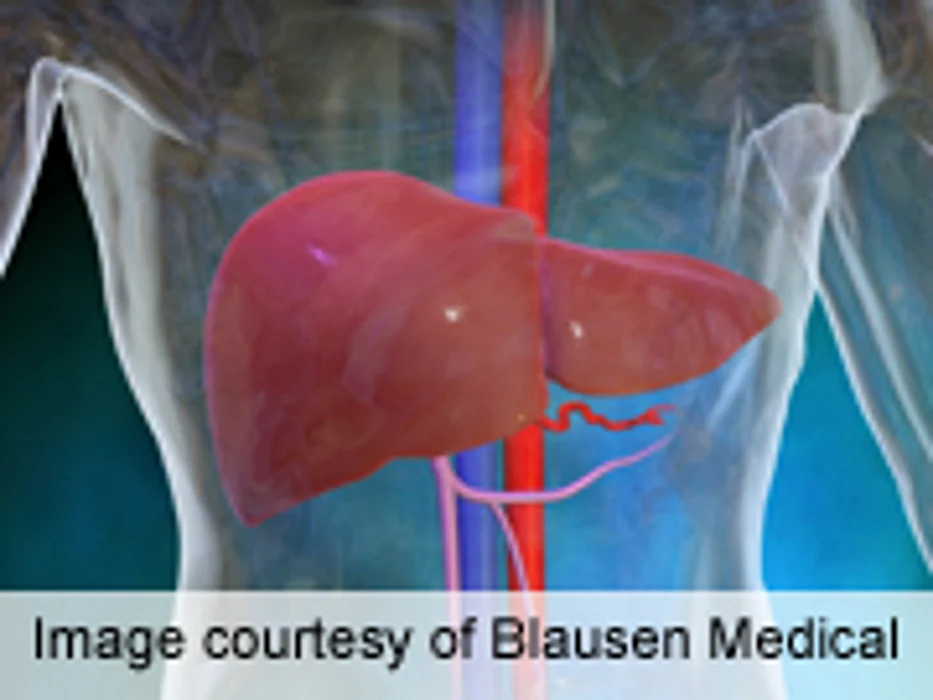 AACR: Diabetes Linked to HCC Risk Across Ethnic Groups