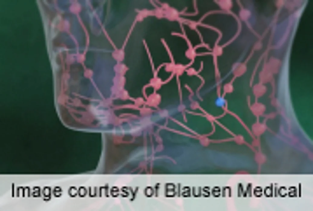 SLNB Doesn't Up Survival in Melanoma Arising in Head, Neck