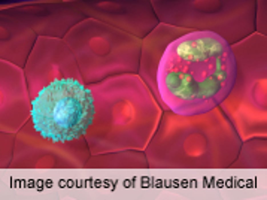 Study Highlights Importance of 'Good' Skin Bacteria in Immunity