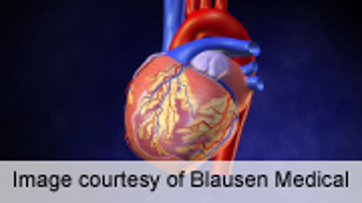 Fifth Link Ups Neuro Outcome in Non-Hospital Cardiac Arrest