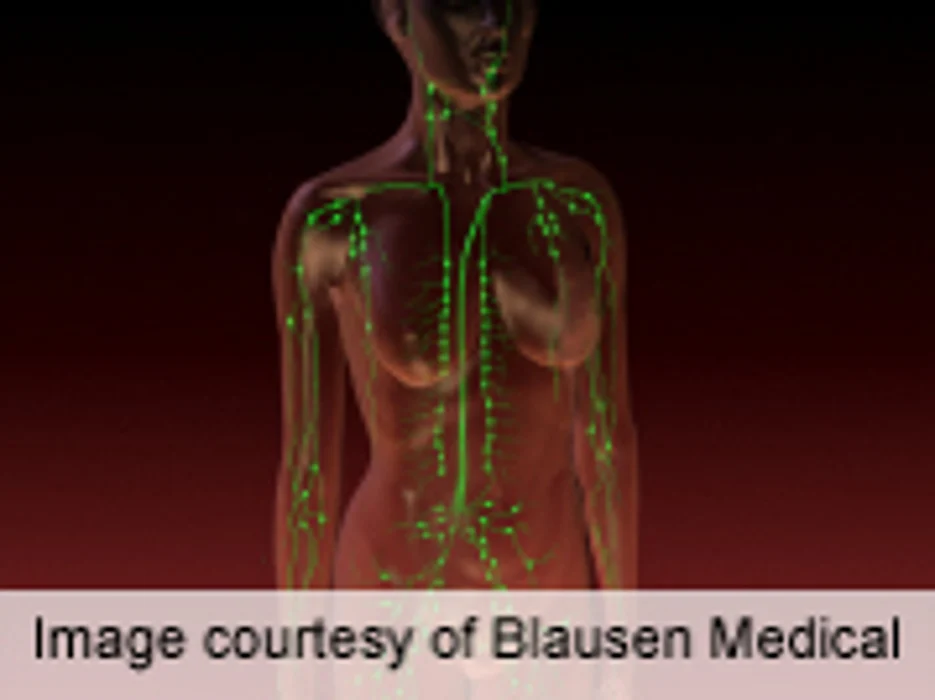 Drug Combo Ups Survival in Metastatic Breast Cancer