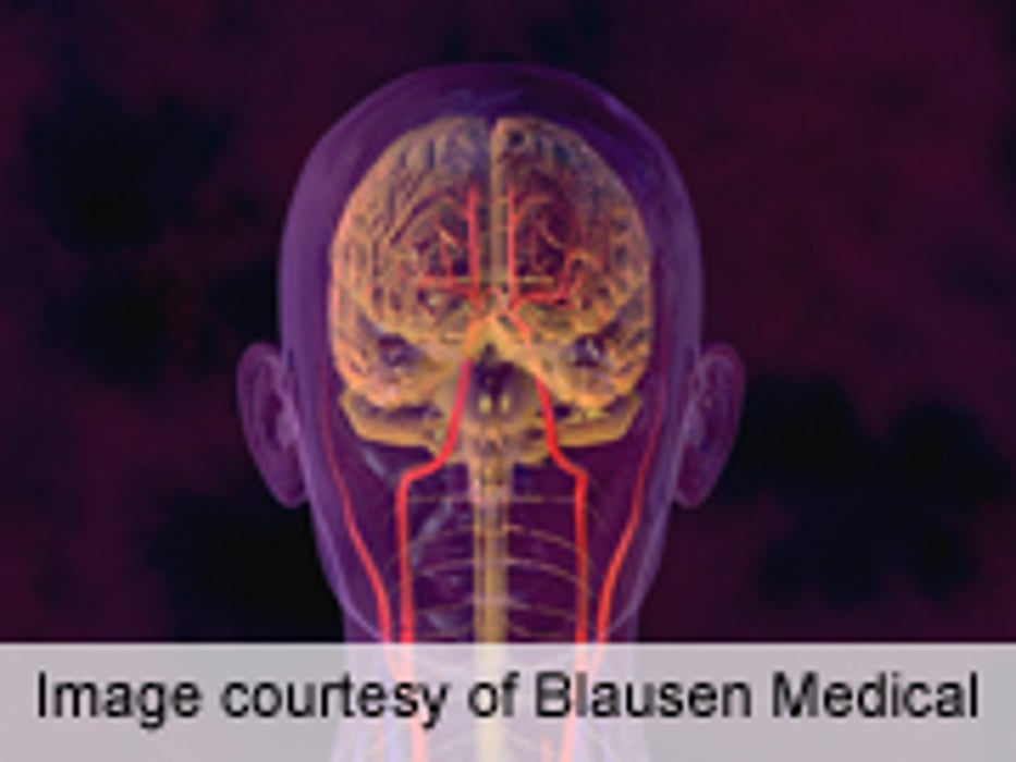 Brain's 'Glymphatic' System Clears Interstitial Solutes