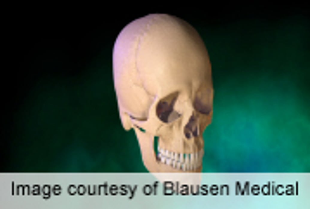 Gene Mutation Linked to Facial, Skull Abnormalities