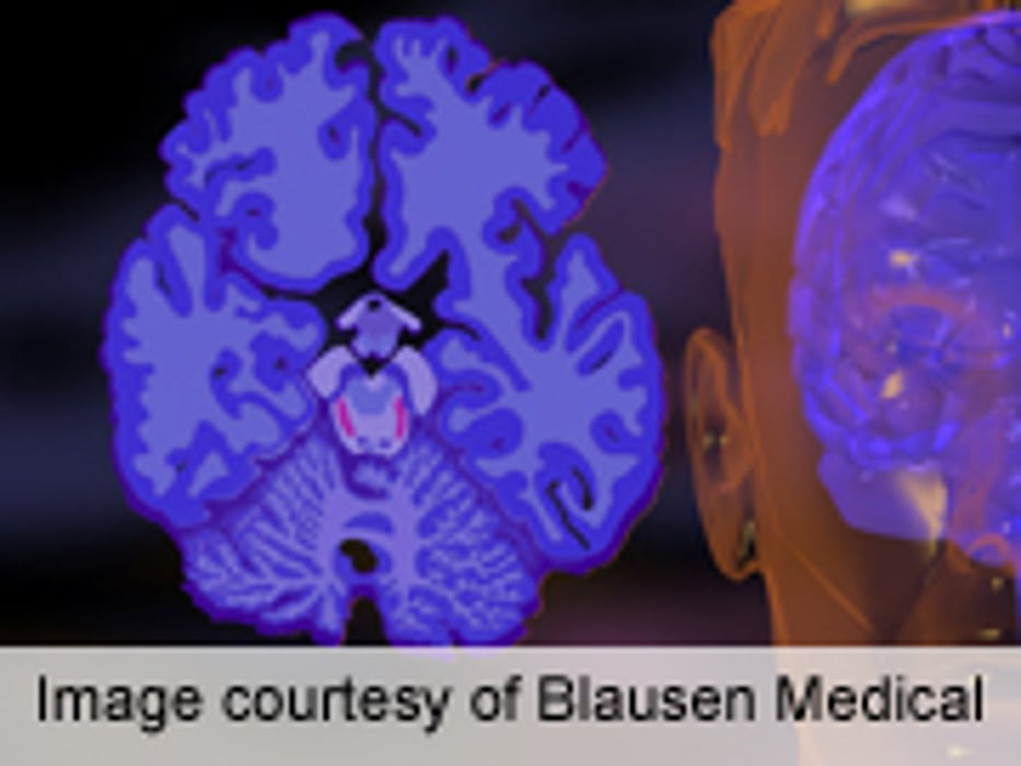 Alpha Tocopherol Seems Beneficial in Alzheimer's