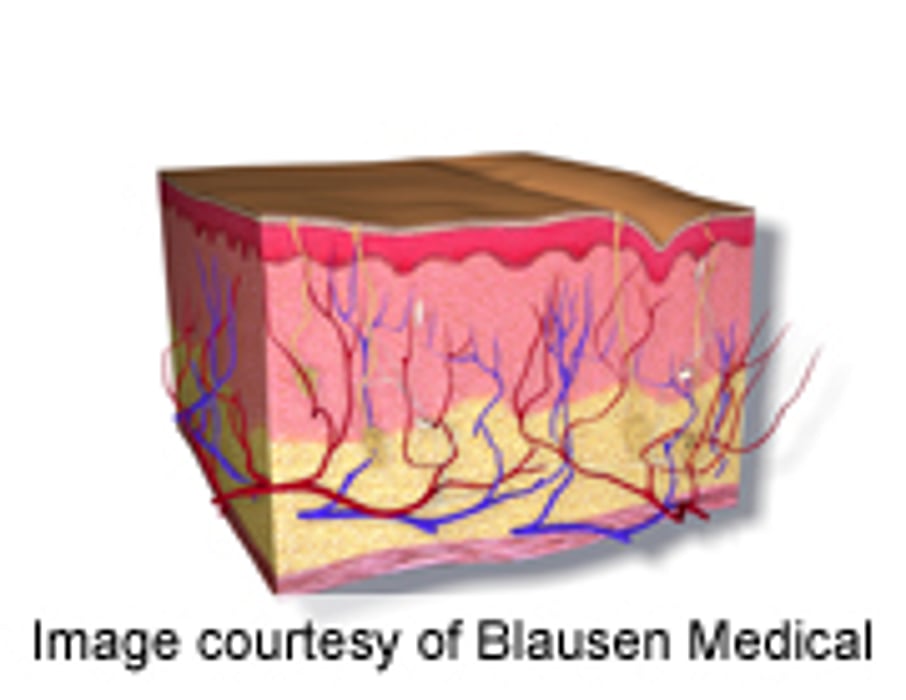 Tedizolid Phosphate Viable for Bacterial Skin Infections