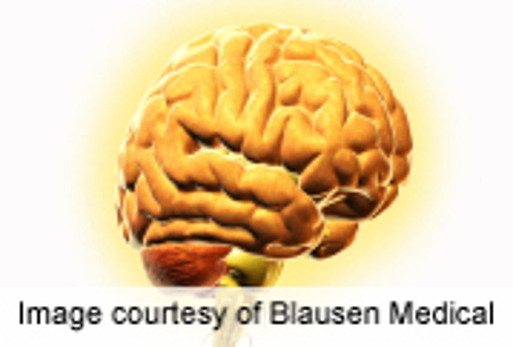 Timeline Detected for Rare, Early Alzheimer's