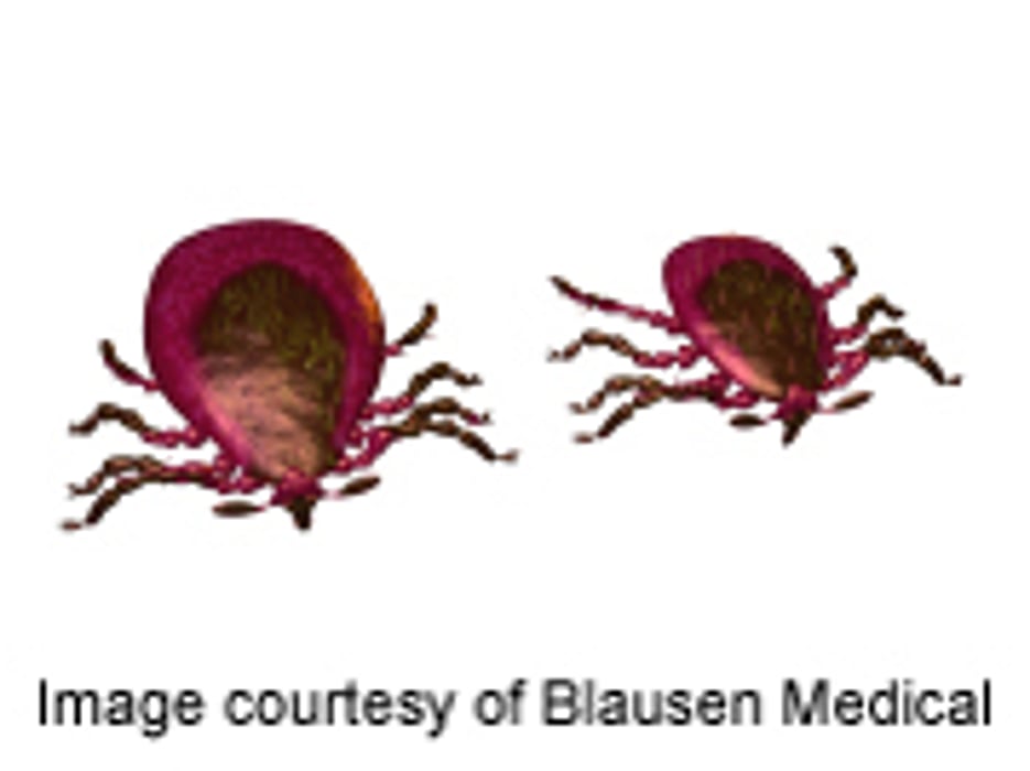 ACAAI: Much of Alpha-Gal Sensitivity Due to Lone Star Tick
