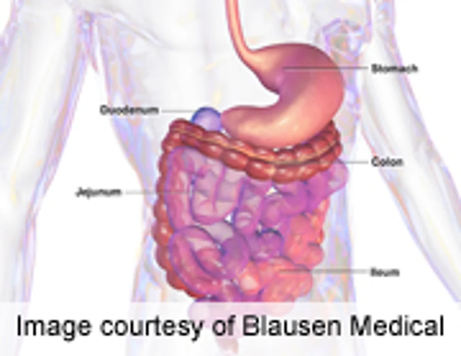 Lymphoma Risk Varies for Celiac Disease Patients