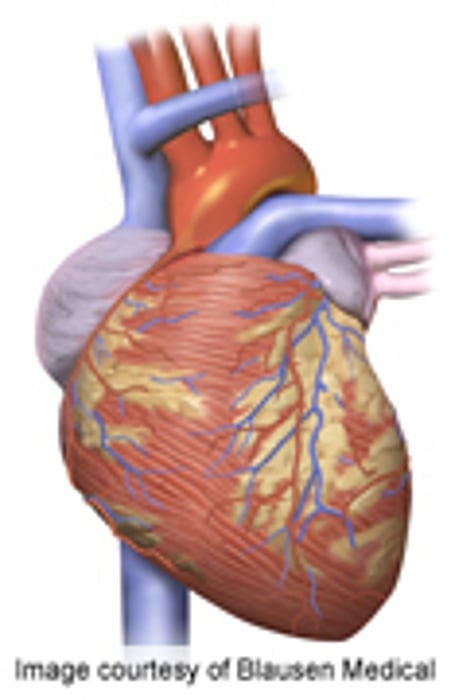 Early Prophylactic Tx Beneficial for Hypertrophic Cardiomyopathy