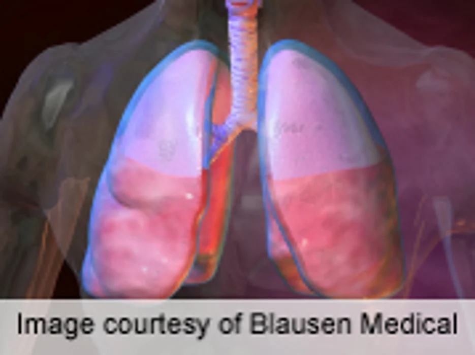 Human Airways' 'Brush' Mechanism Gives Clues to Lung Diseases