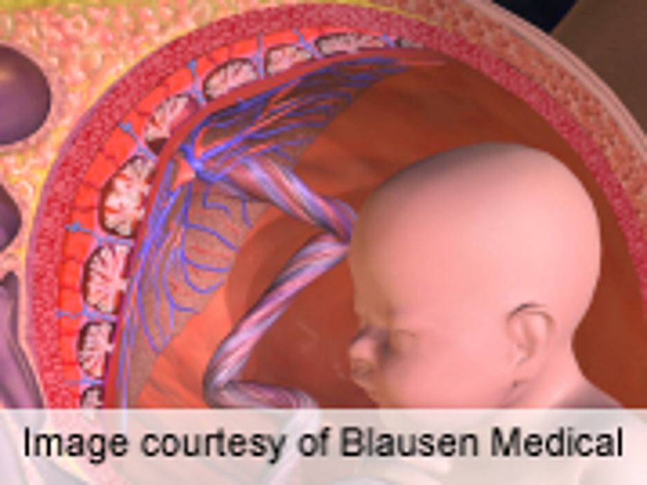 Variation Noted in Pattern of Alcohol-Related Birth Defects