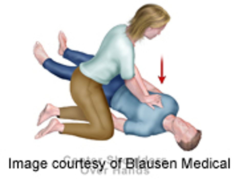 Survival More Likely With Exercise-Related Cardiac Arrest: Study