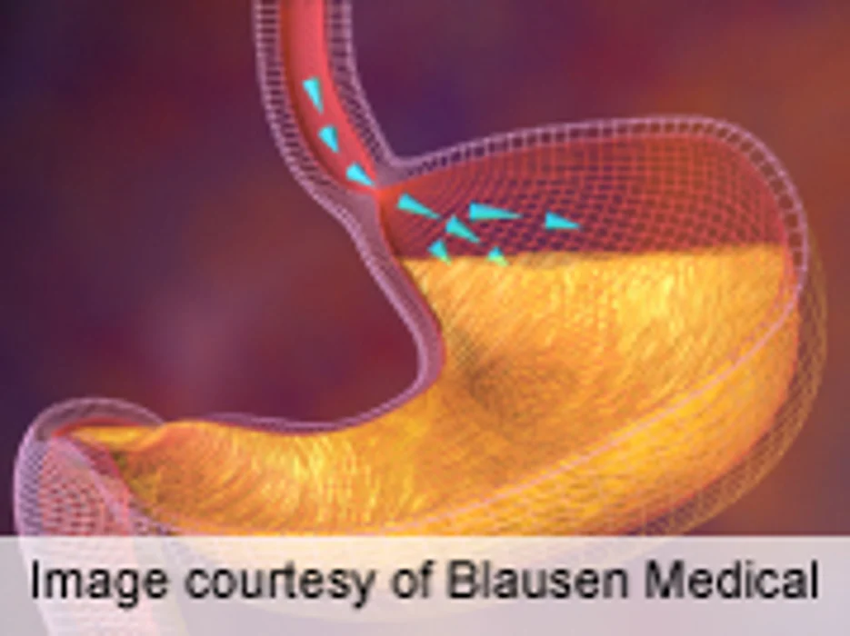 Human Whey Better Promotes Gut Bacteria Colonization