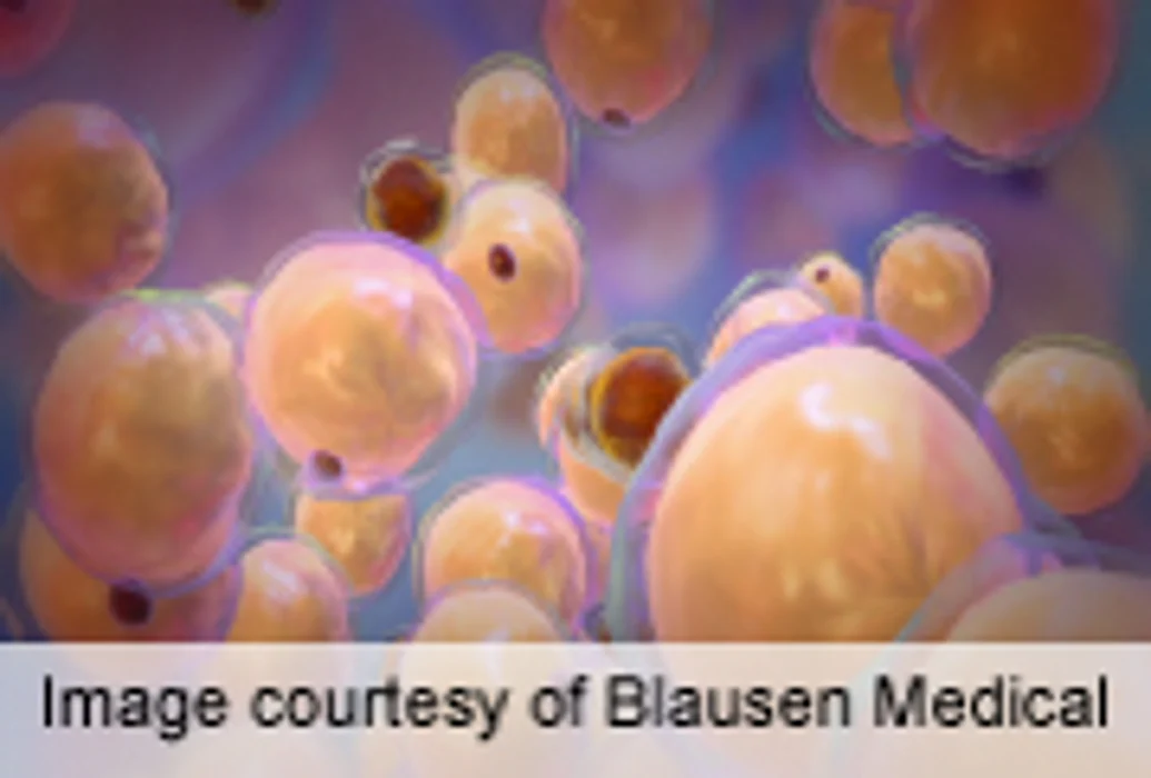 Congenital Disease Linked to Adipocyte Development