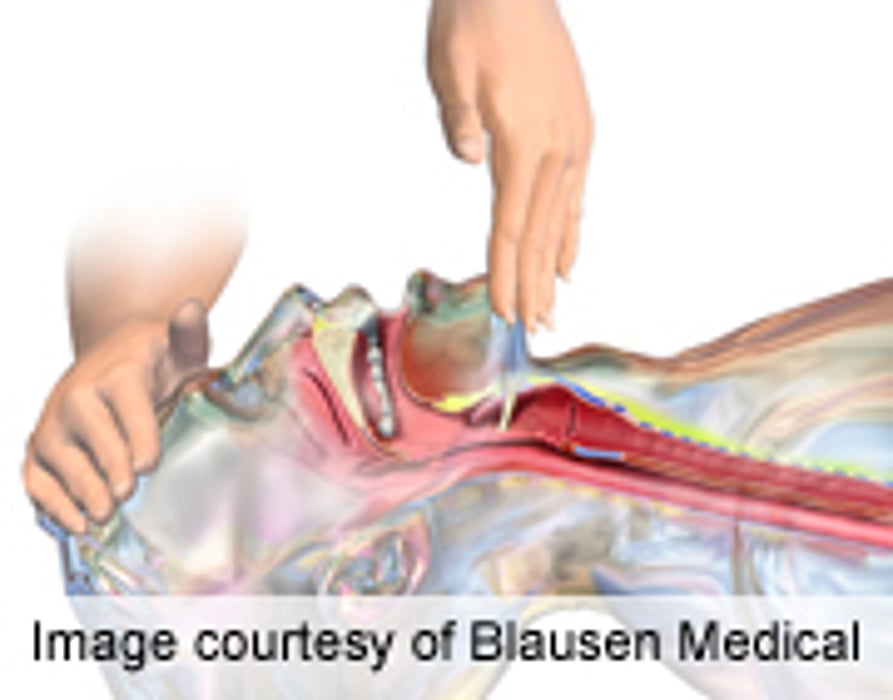 AHA: CPR of at Least 38 Min Advisable in Cardiac Arrest