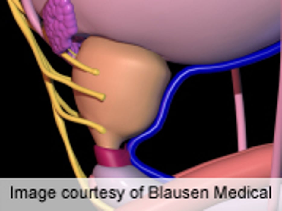 Intermittent ADT Noninferior to Continuous ADT for Prostate CA
