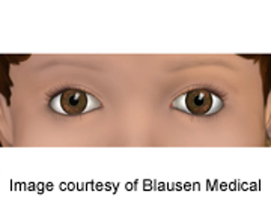 Simple Eye Tracking Can Identify Neurological Disorders